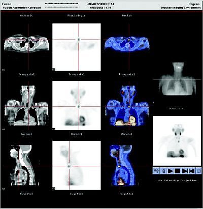 2005 04 06 14 10 48 706