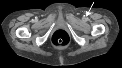 2005 04 08 11 14 34 706