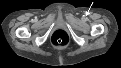 2005 04 08 11 14 34 706