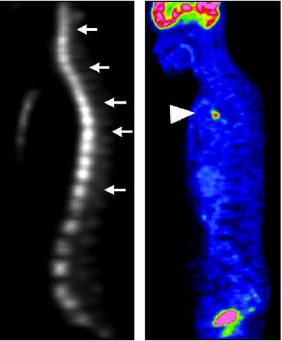 Roentgen Signs in Diagnostic Imaging: The Chest