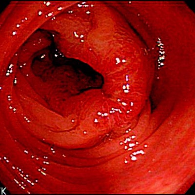 2005 04 29 14 03 18 706