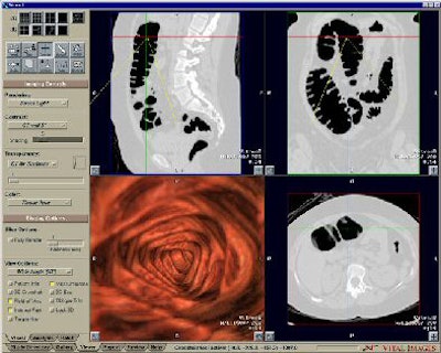 2005 04 29 14 40 06 706