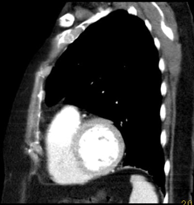 2005 05 06 11 59 15 706