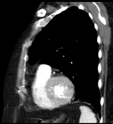 2005 05 06 11 59 41 706