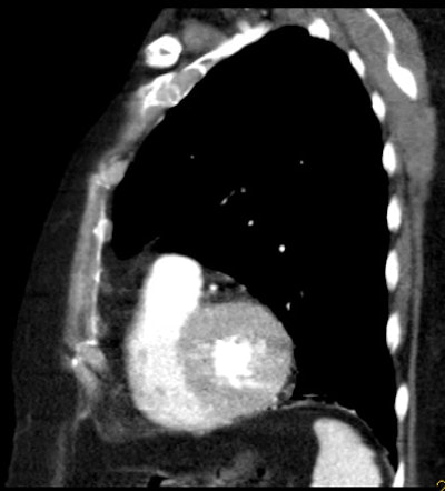 2005 05 06 11 59 41 706