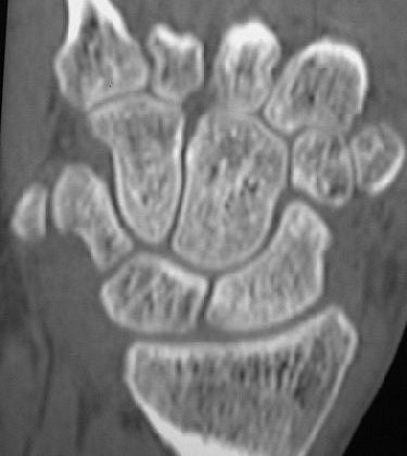 2005 05 17 15 55 55 706