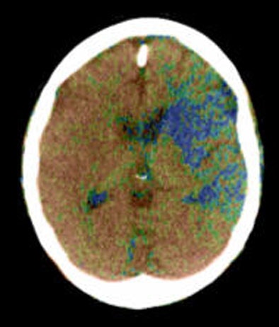 2005 05 31 16 00 51 706