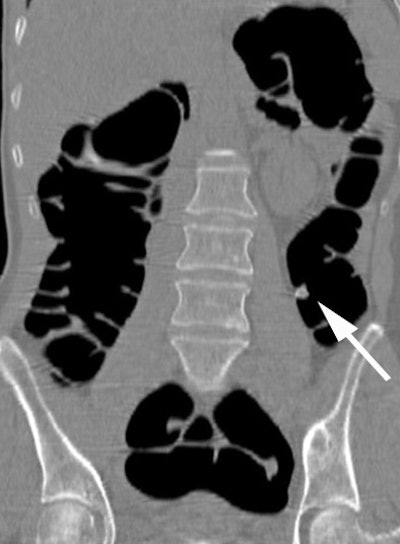 2005 06 06 10 03 15 706