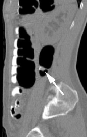 2005 06 06 10 10 51 706