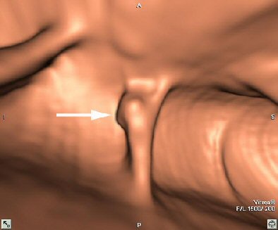 2005 06 06 10 11 12 706