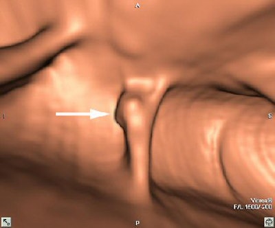 2005 06 06 10 11 12 706