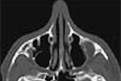 2005 06 09 11 52 56 706