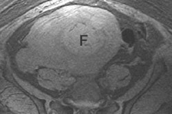 2005 06 10 15 49 15 706