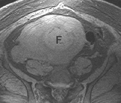 2005 06 10 15 49 15 706