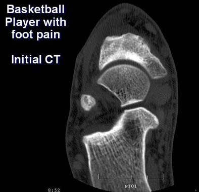 2005 06 17 16 21 28 706