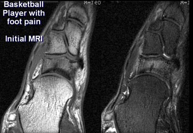 2005 06 17 16 21 49 706