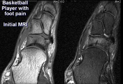 2005 06 17 16 21 49 706