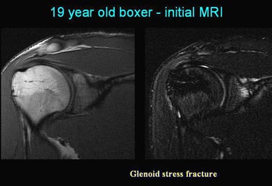 2005 06 17 16 22 10 706