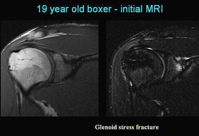 2005 06 17 16 22 10 706