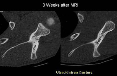 2005 06 17 16 22 23 706