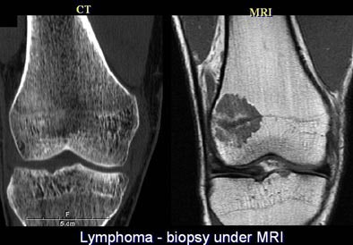 2005 06 17 16 22 44 706