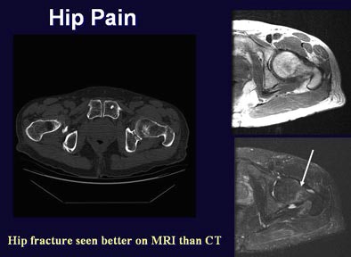 2005 06 17 16 23 16 706