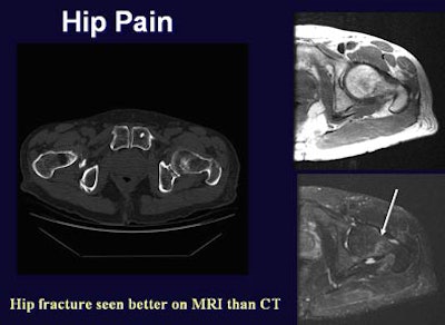 2005 06 17 16 23 16 706