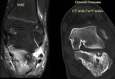 2005 06 17 16 23 49 706