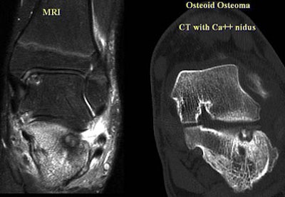 2005 06 17 16 23 49 706