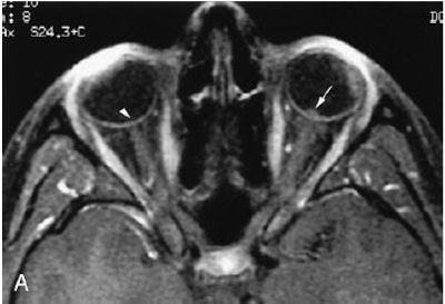 2005 07 01 14 13 21 706