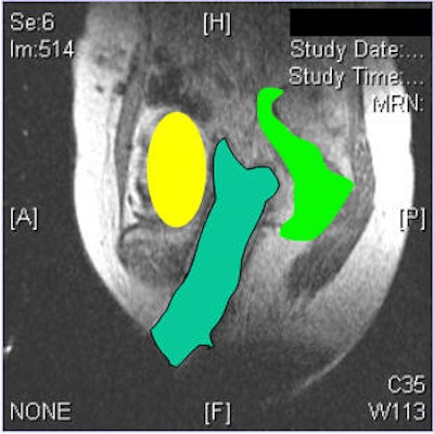 2005 07 01 15 55 35 706