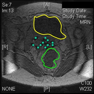 2005 07 01 15 55 49 706