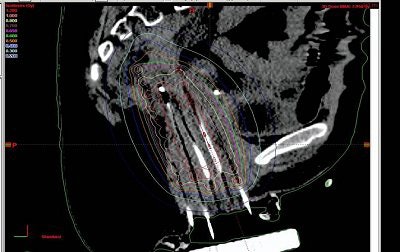 2005 07 01 15 56 06 706