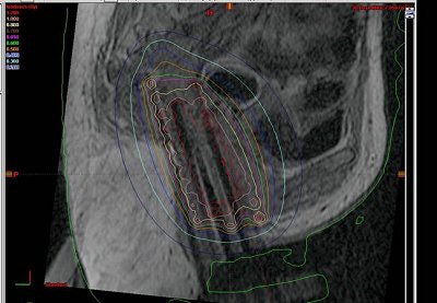 2005 07 01 15 56 22 706