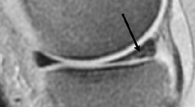 2005 07 05 14 46 57 706