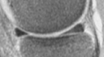 2005 07 05 14 47 16 706