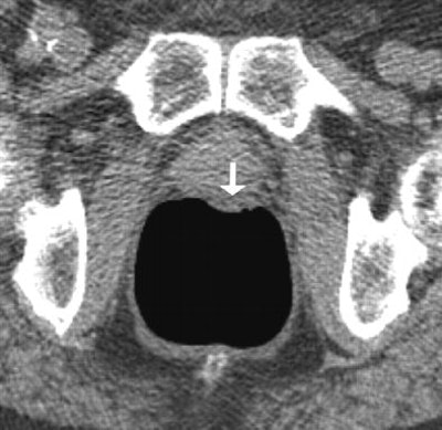 2005 07 12 14 37 09 706