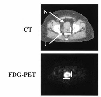 2005 07 13 16 01 52 706
