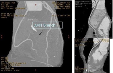 2005 07 25 14 26 00 706