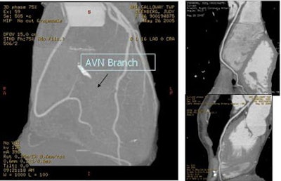 2005 07 25 14 26 00 706