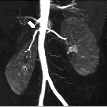 2005 07 28 15 16 05 706