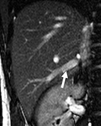 2005 07 28 15 17 19 706