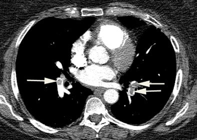 2005 08 05 11 00 01 706