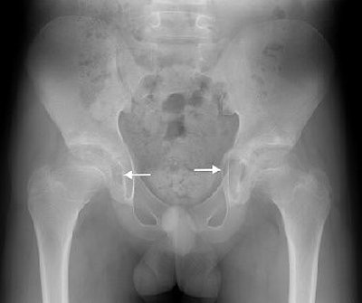 2005 08 09 14 51 24 706