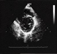 2005 08 15 13 52 16 706