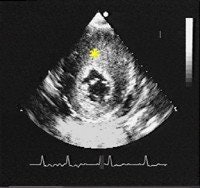 2005 08 15 13 52 45 706