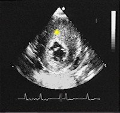 2005 08 15 13 52 45 706