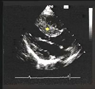 2005 08 15 13 53 04 706