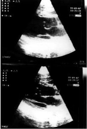 2005 08 15 13 53 58 706