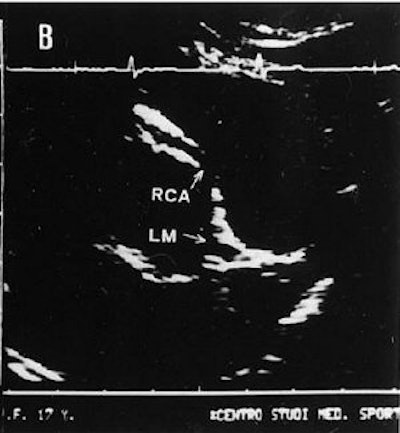 2005 08 15 13 54 44 706